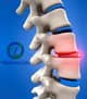 Slider image (10) MexStemCells Clinic for Chronic Degenerative Wellness